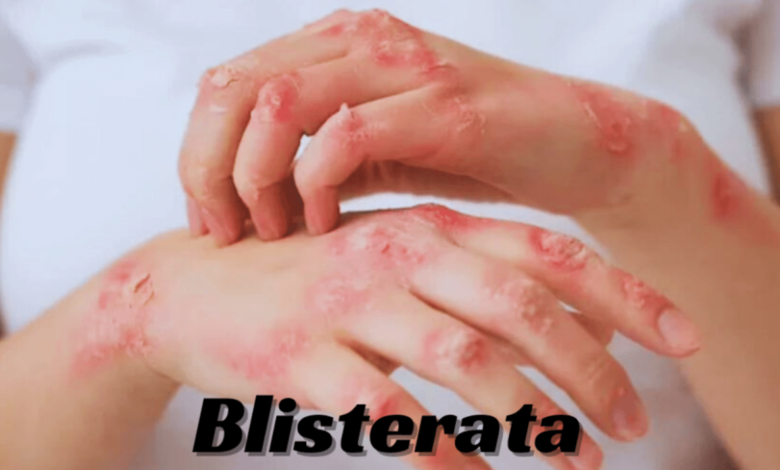 Blisterata